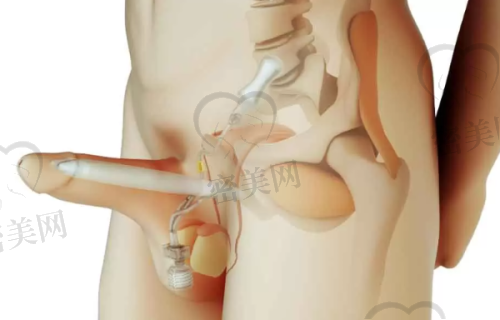 眼部整形价格一览:埋线到修复,全明码标价