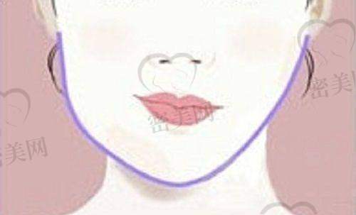 哈尔滨瑞丽整形医院到底靠谱吗?