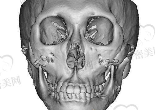 佳木斯友晟医疗美容:细节与术后服务见长