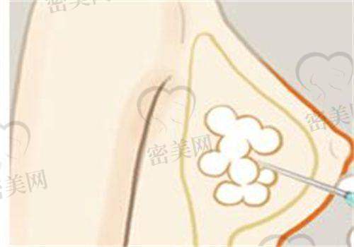 宜昌华美医疗美容门诊部