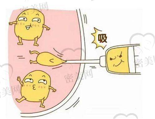 佳木斯艾美医疗美容医院:私立整形品牌标杆,主打声波体雕与高端眼修