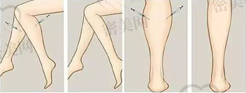 术后修复&护理指导到位,六项术后关爱机制保护修复成效