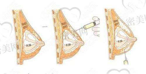 孙延昌医生团队坐镇,重点项目坐实性价比之王