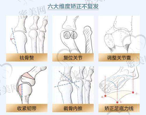 昆明娇点整形美容医院:下颌角、颧骨项目稳扎稳打