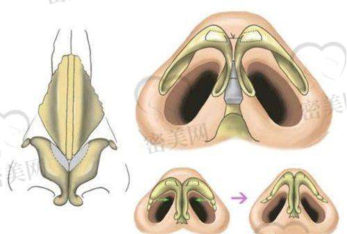 房志强医生技术特点: