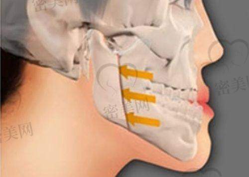 昆明维多利亚医疗美容医院:亲切服务+轻医美代表