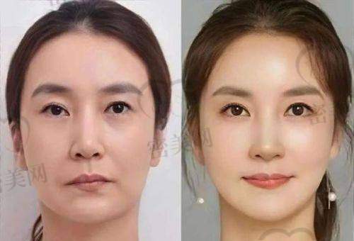 昆明韩辰医疗美容医院用户口碑评价好不好?