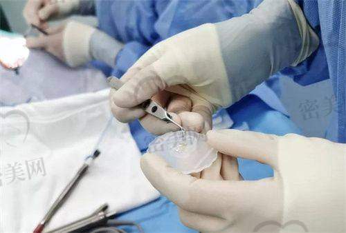 医生团队从业多年、服务贴心