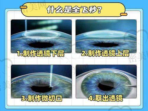 东莞常平健明眼科医院有哪些适合不同人群的就诊推荐?
