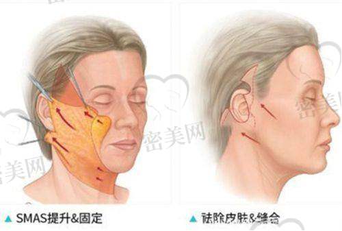 【王媛医生擅长项目】