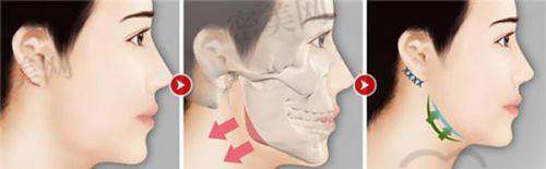 真实顾客对哈尔滨瑞丽整形医院的评价