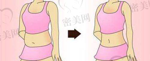 吸脂项目明细价目:腰腹马甲线/腿部/面部精细化雕刻