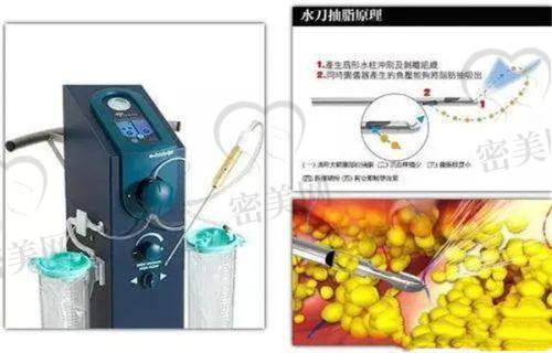 上海九院激光科医生团队与预约建议