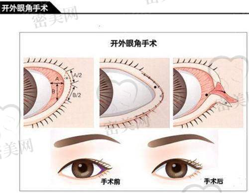 太原圣贝拉医疗美容