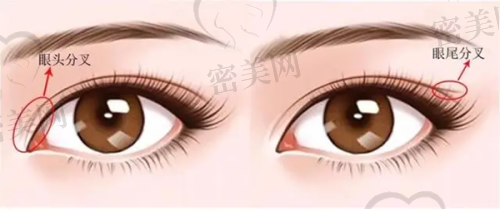 昆明梦想医疗美容医院:修复与自然风鼻整优选