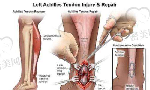 太原整形热门项目趋势解析