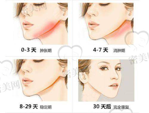 其他热门美容项目价格附表