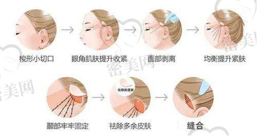 【王媛医生怎么预约挂号？】