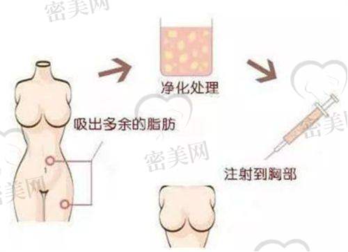 私立优质推荐:哈尔滨羽禅医疗美容门诊部,吸脂+眼部项目反馈出色