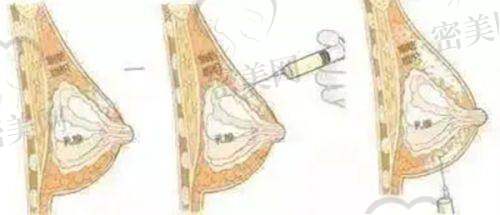 上海九院抗老紧肤类项目费用细节