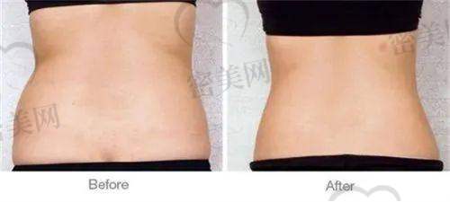 童妍医疗美容中 心:敏感肌的美肤乐园