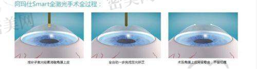 东莞常平健明眼科医院正规资质如何?医院靠谱吗?