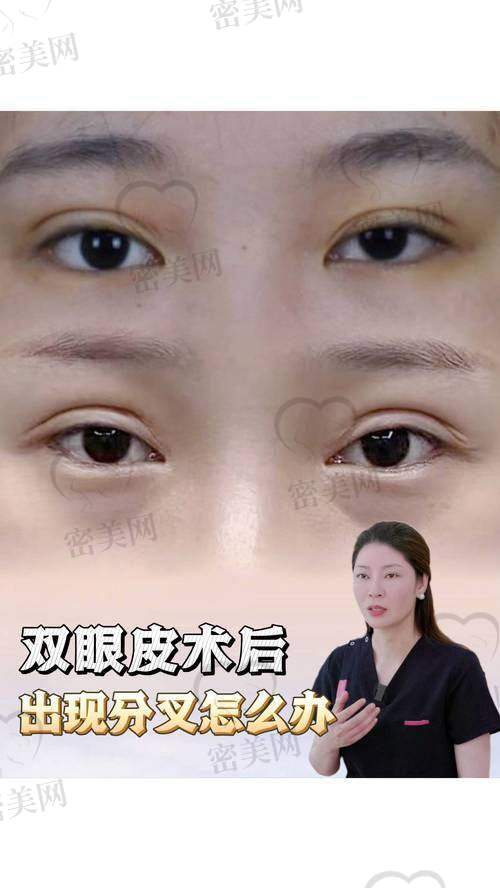 唐山煤医尚美整形医院郭万厚:技术不错的双眼皮大师