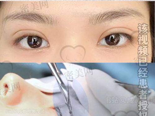 谭敏峰医生挂号技巧实战指南