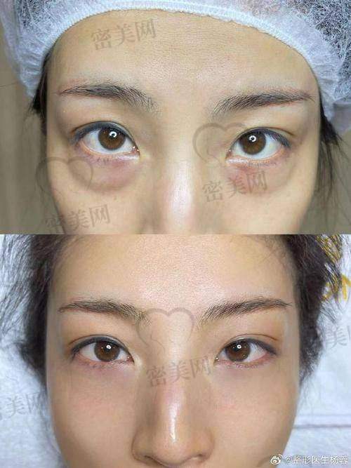 黑龙江瑞丽整形(宋桂霞)