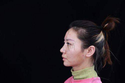 变得更美后的快乐:开启容貌新海内外