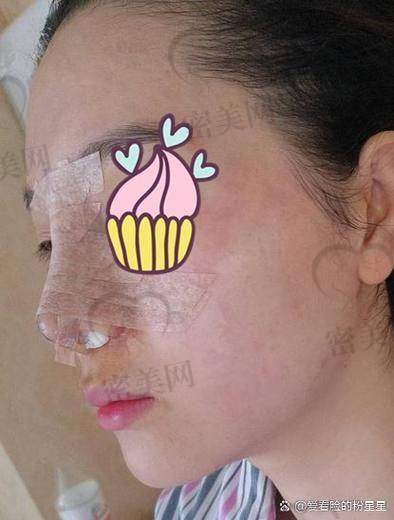 房志强医生擅长项目: