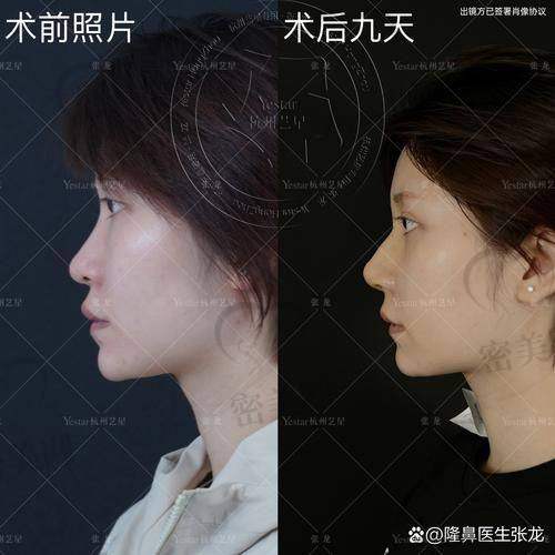 房志强医生个人资料简介: