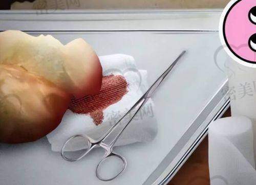 上海瑞金医院整形科(邹立坤)