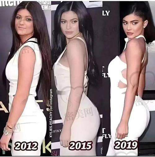 选择正规医院和医生