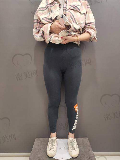 唐山煤医尚美王晓娟:8800 元开启美腿魔法之旅