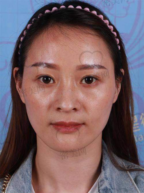 梁耀婵医生技术特点: