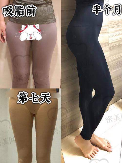 口碑爆棚:王晓娟美腿魔法获众人点赞