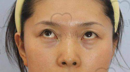 哈尔滨即美整形——快节奏疗效体验