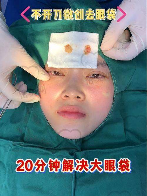 李风浩私人眼整形工作室