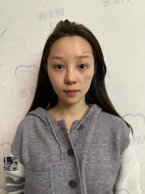 初见房志强医生:专精与亲切并存