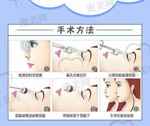 手术:紧张又期待的“变身之旅”