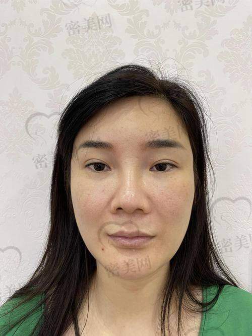 房志强医生怎么预约挂号?