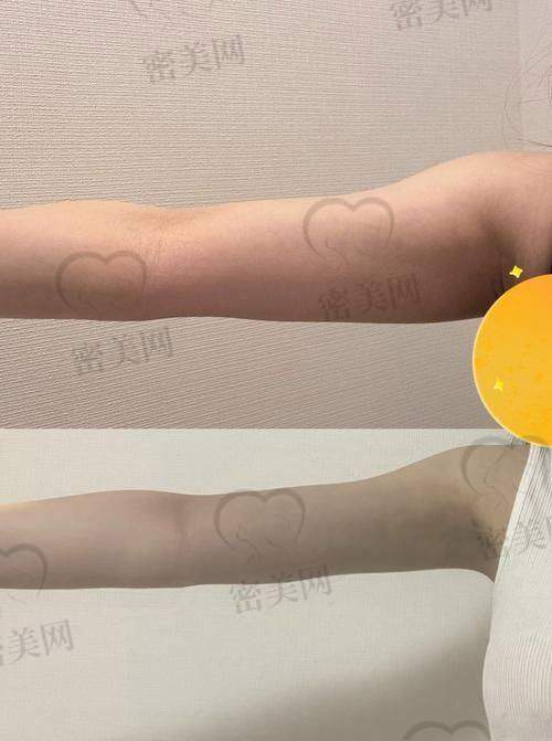 哈尔滨艺星整形吸脂服务体验保护:不止价格,服务也贴心