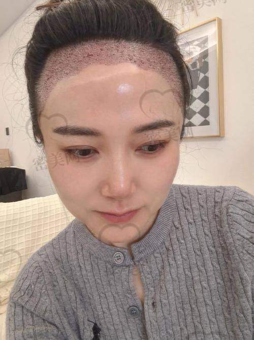 福州青逸植发:高性价比新贵,个性审美设计突出