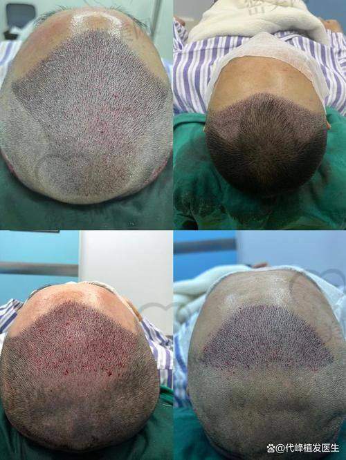 上海雍禾植发医院怎么样?从医院实力看起