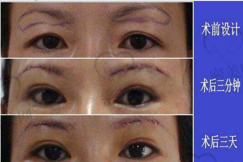 唐山煤医尚美整形医院郭万厚:医生实力超硬核!