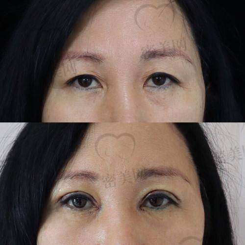 唐山煤医尚美王晓娟:医生实力大曝光