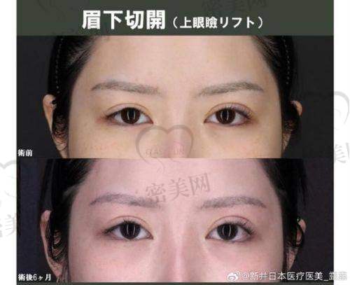 口碑爆棚:唐山煤医尚美王晓娟切眉受追捧