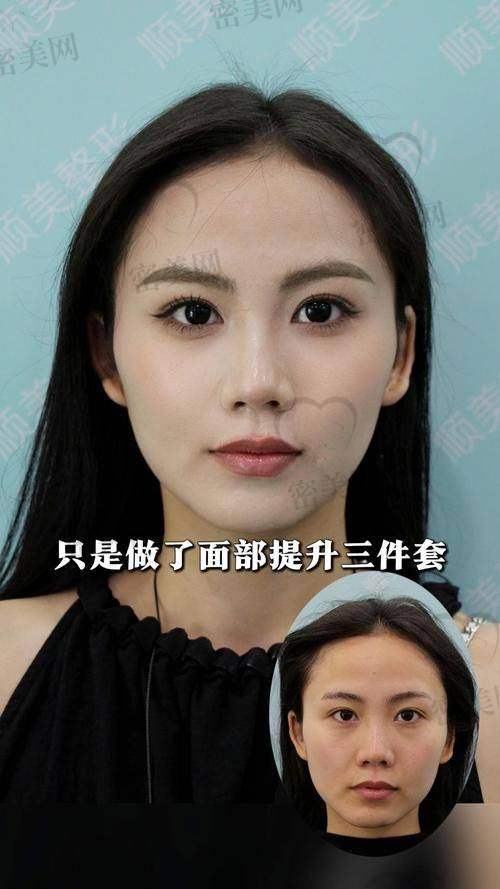 唐山煤医尚美整形医院:微拉美项目的“美丽殿堂”