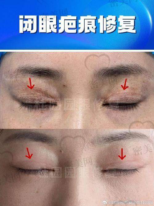 唐山煤醫(yī)尚美:切開雙眼皮的“美麗搖籃”